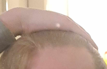 hairline 1, 2024.png