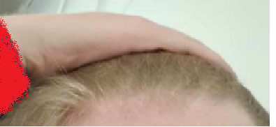 hairline 2, 2024.png