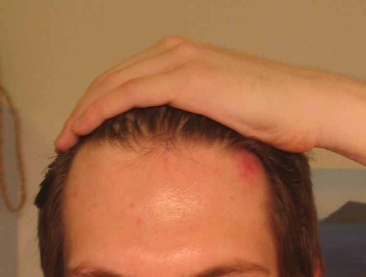 HairLossTalk.com 0 - Kopie.jpg