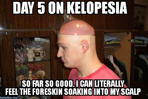 HairLossTalk.com kelo.jpg