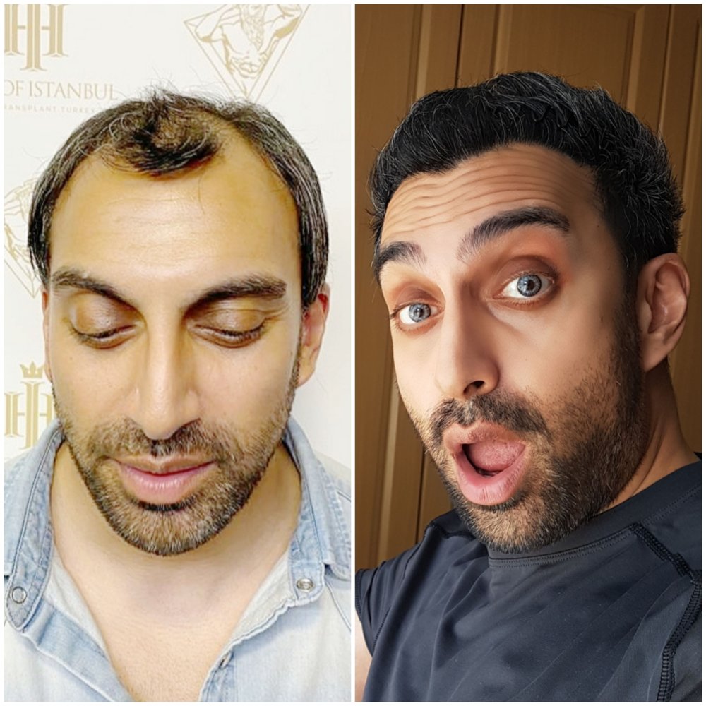 HOI Before After.jpg