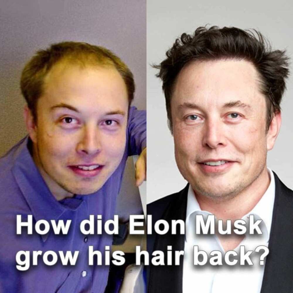 how-did-elon-musk-grow-his-hair-back-1024x1024.jpg