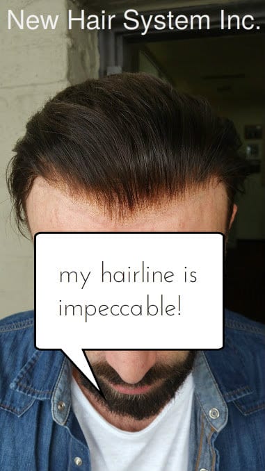 impeccable-hairline.jpg