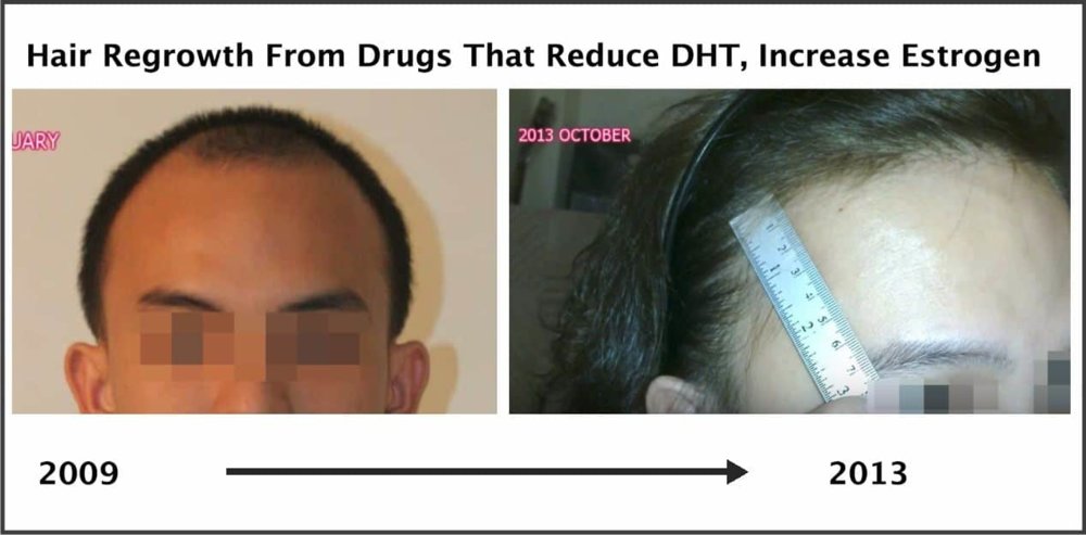 increase-estrogen-decrease-dht-hair-growth-compressor.jpg