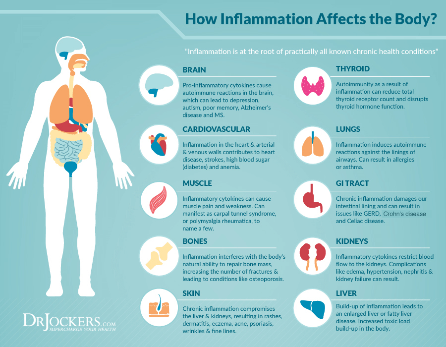 Inflammation-diagram2.png