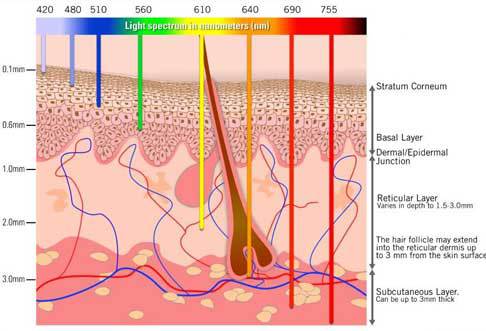 ipl-light-spectrum1.jpg