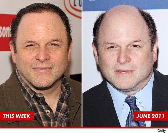 jason-alexander-hair-growth-week-credit.jpg