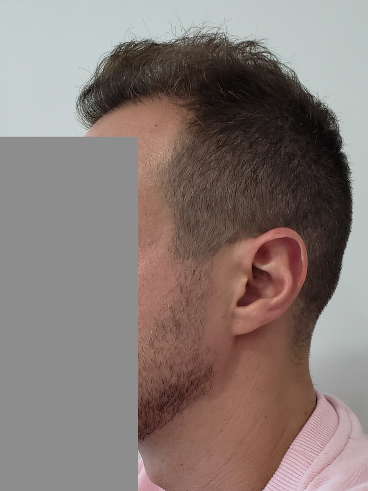 left side of hair copy.png