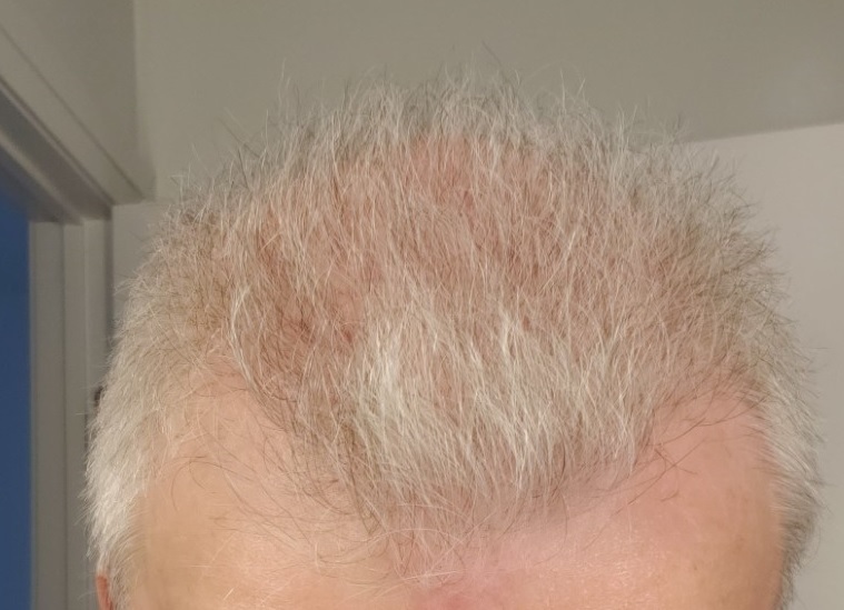 Month 4 -   Jan 15 to Feb 15.jpg