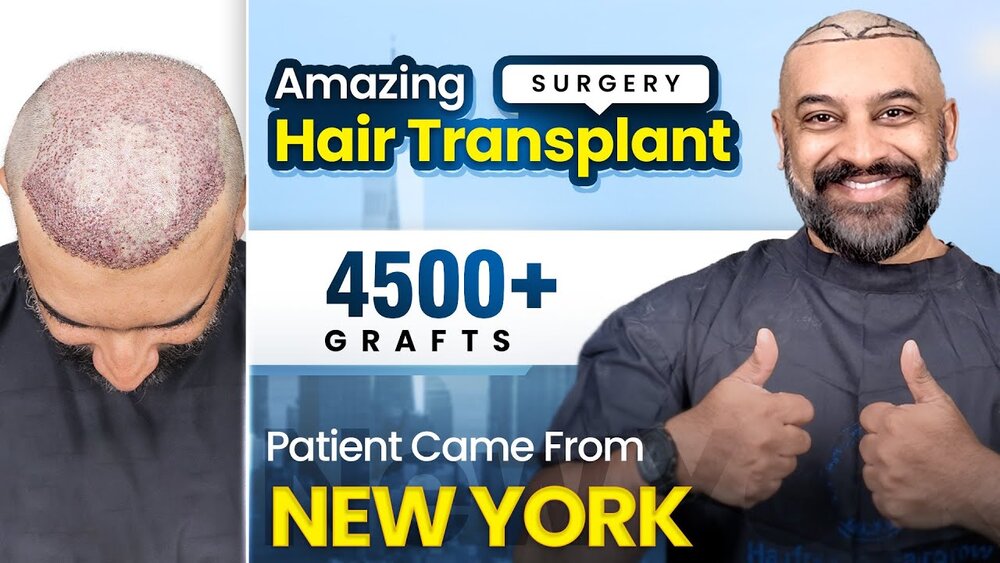 new york to india for hair transplant.jpg