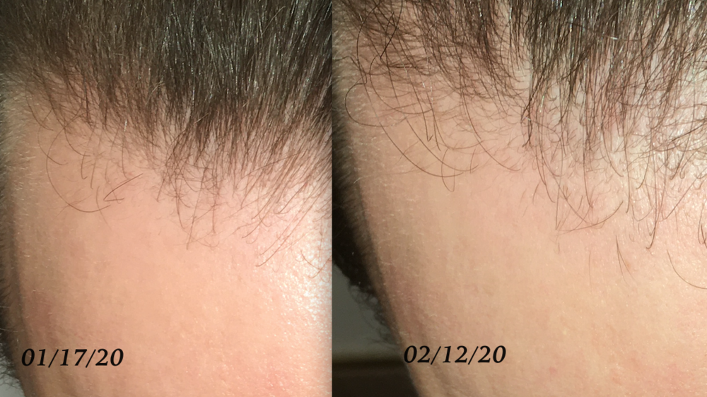 NGF 3 weeks difference.png