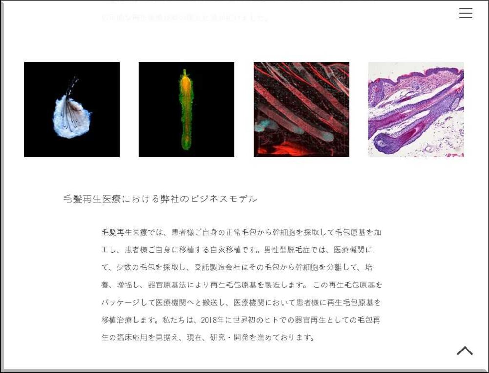 Organ-Technologies-Inc-Our-business-model-in-hair-regeneration-medicine.jpg