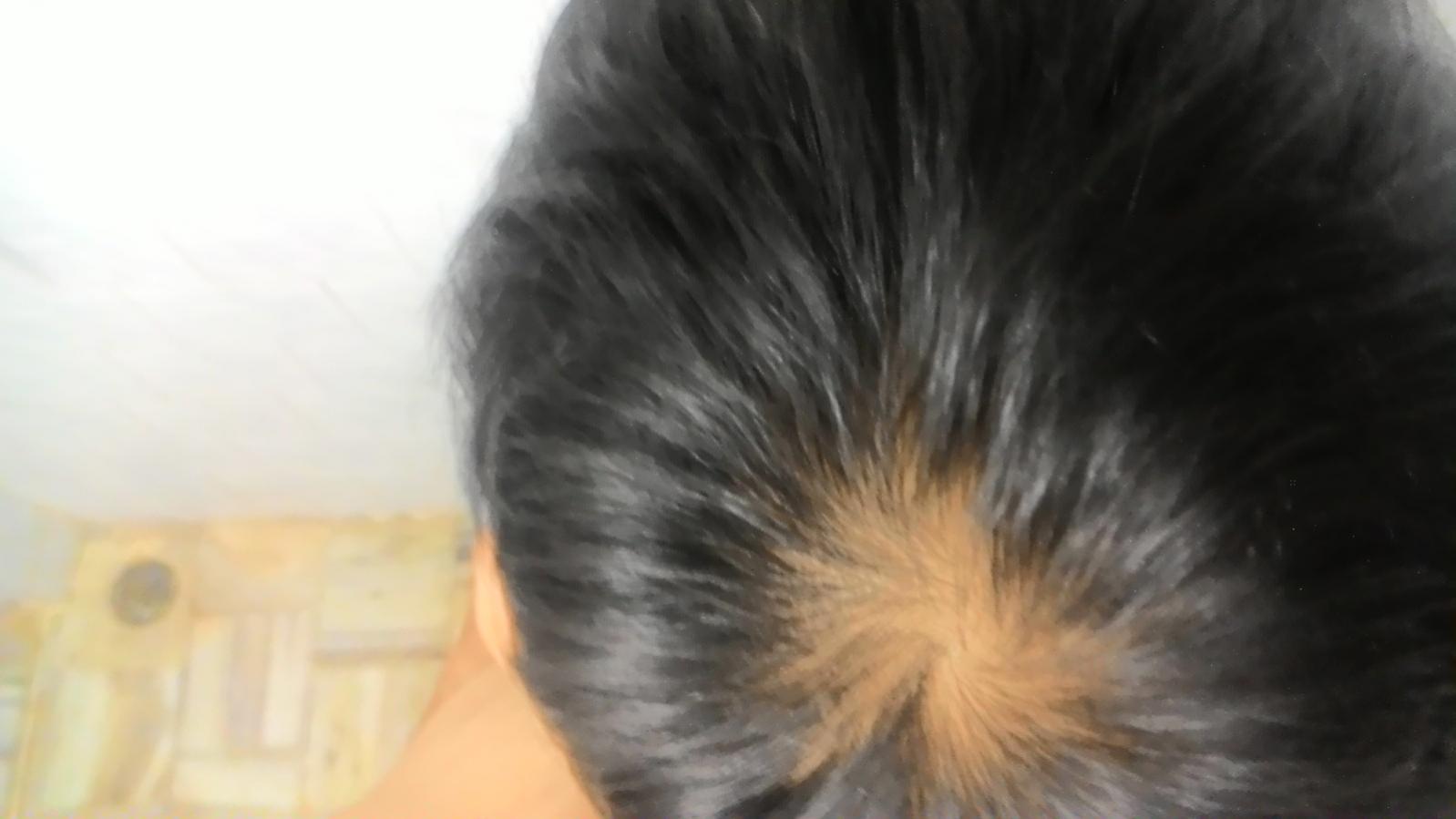 p_20151023_163036-jpg.36305