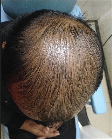 Patient 2 - 6 months.jpg