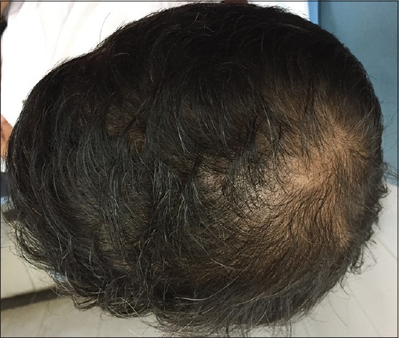 patient 4 - 6 months.jpg