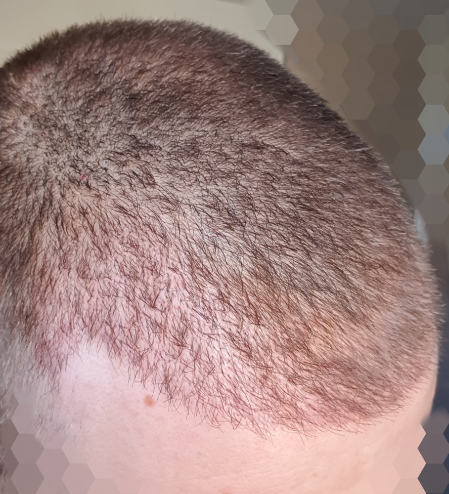 Point Blur_Sep212019_130410.jpg