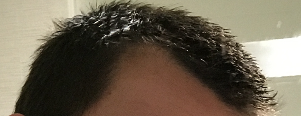 PreTP2 right side.png