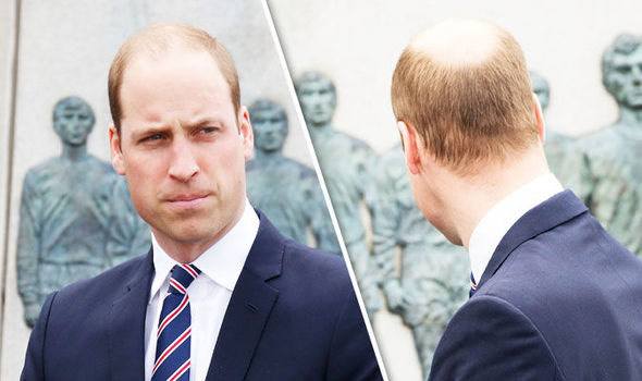 prince-william-bald-spot.jpg