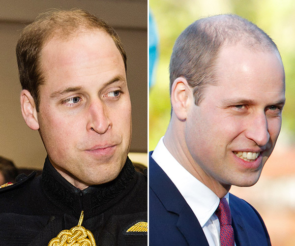prince-william-hair-makeover-short-gty-ftr.jpg