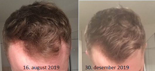 Progression 4 and a half months.png