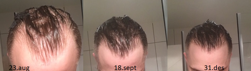 Progression wet hair.png