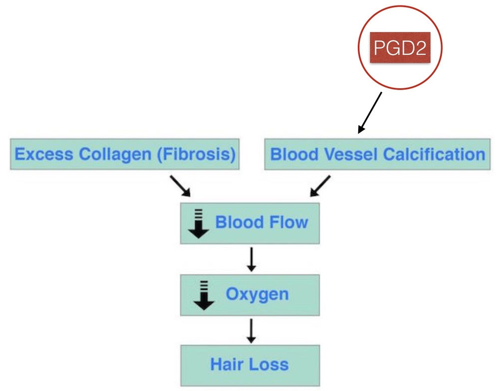 Prostaglandin-D2-Calcification-Hair-Loss.jpg
