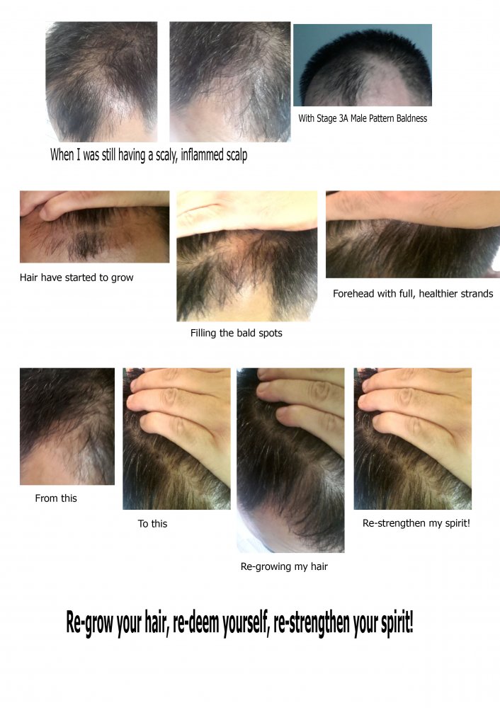 Re-grow your hair!.jpg