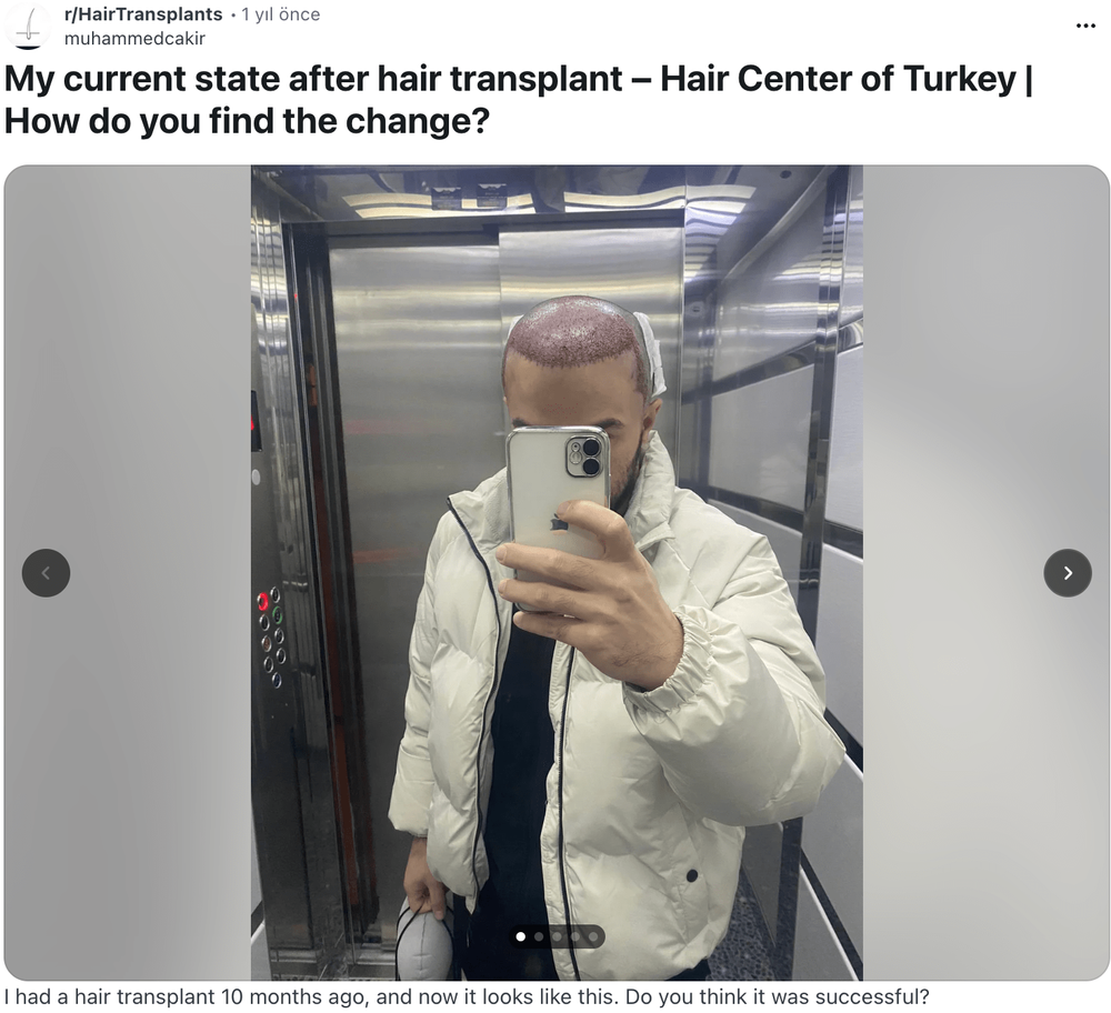 RedditttResult.png