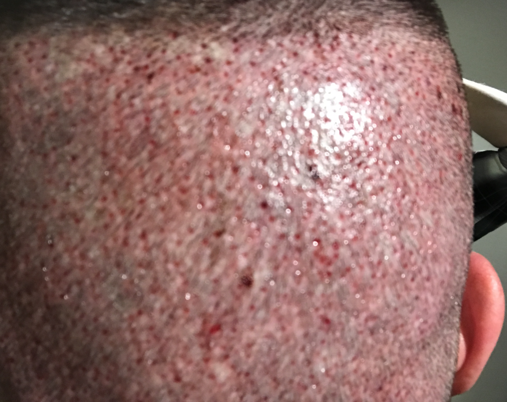 Revision Donor day 1.png