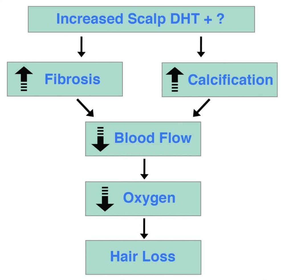 Scalp-DHT-Fibrosis-Calcification-1024x1004.jpg