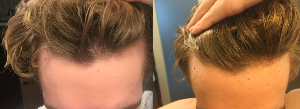 Screen Shot 2017-08-19 at 12.54.33.png