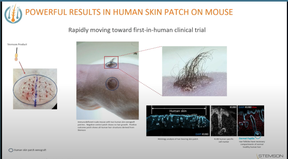 Screen Shot Stemson1.png