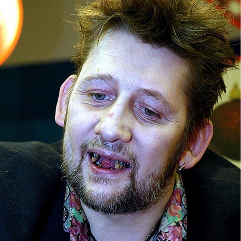 shane-macgowan-pic-rex-903275466.jpg