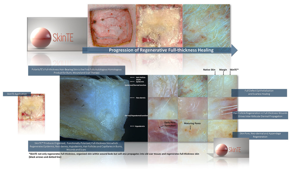 skin-Telogen Effluvium-2b.jpg