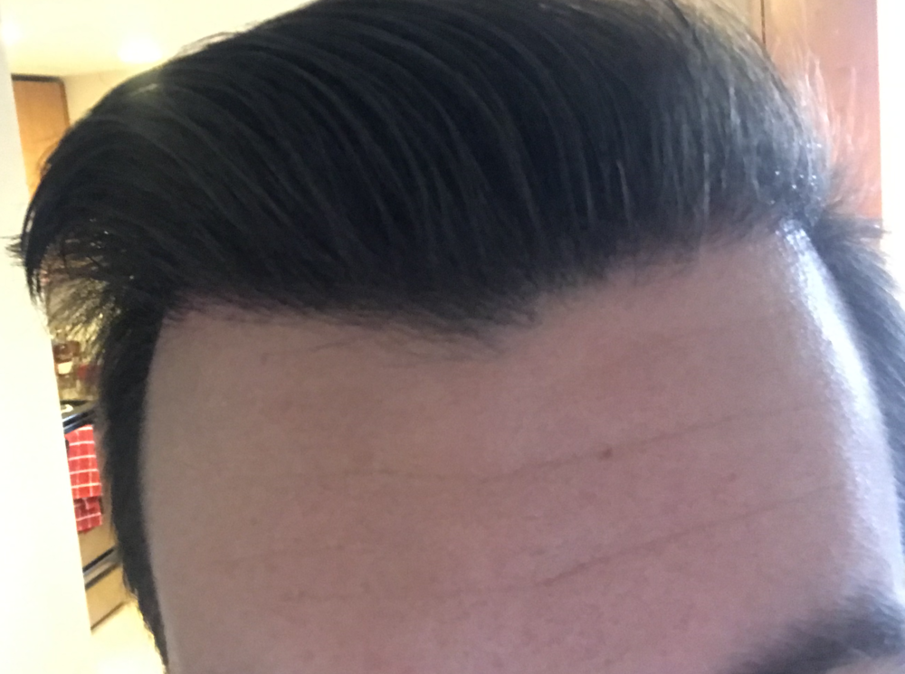 TP3 front 2.5 months.png