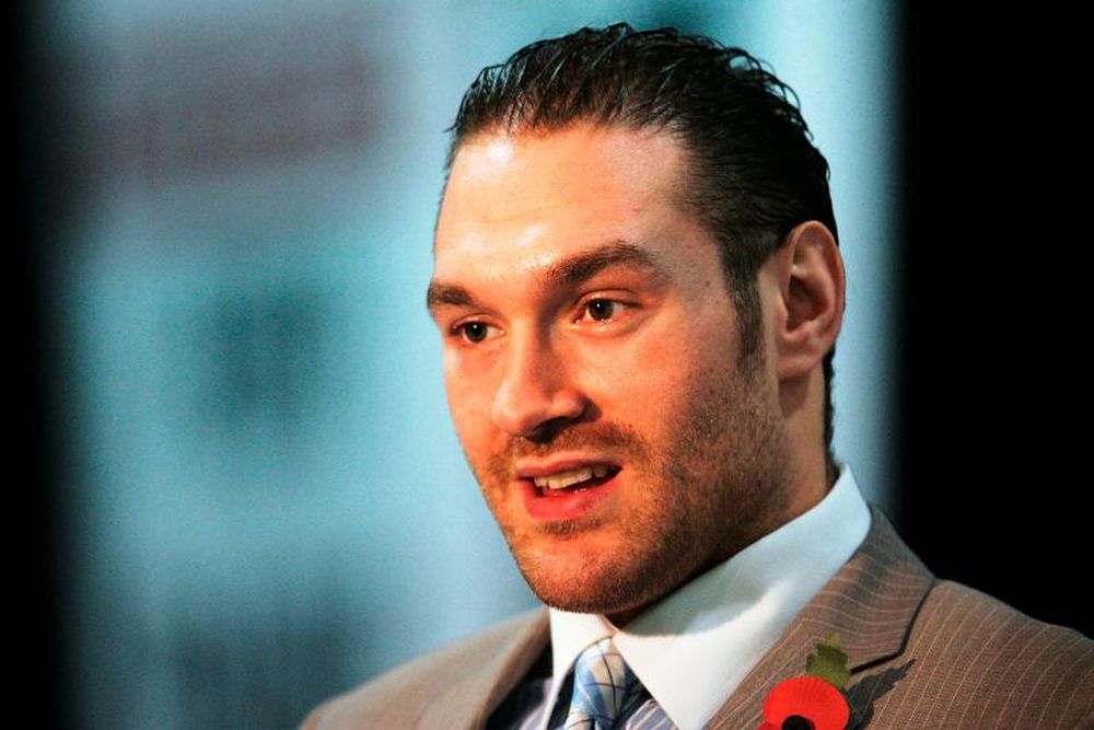 It's A Shame How Much Better Tyson Fury Looked With Hair | HairLossTalk