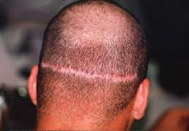 upload_2017-10-9_20-41-4.jpeg upload_2017-10-9_20-41-4.jpeg