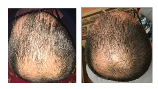 upload_2017-5-6_9-35-12-png.52729