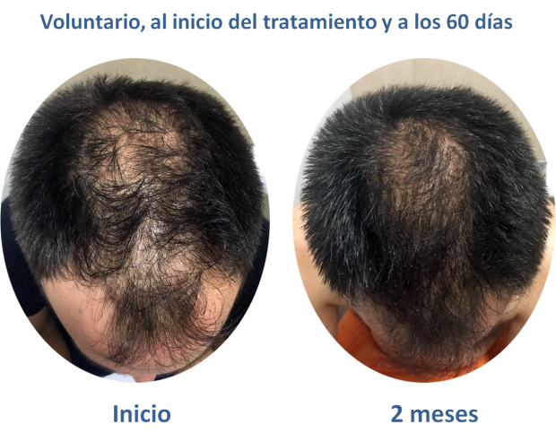 vytrus paciente ensayo.png