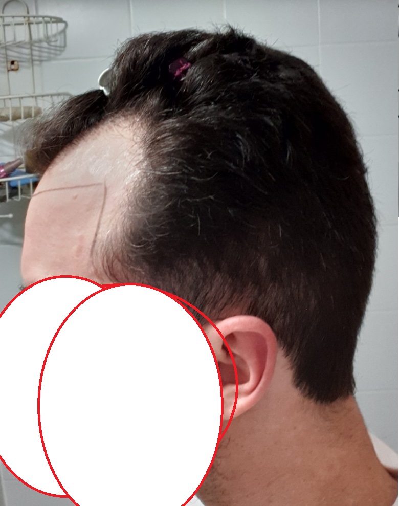 wanted hairline 2.jpg