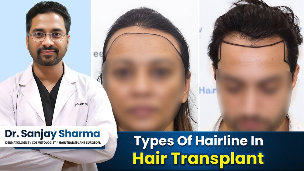 What's YOUR Hairline Type.jpg