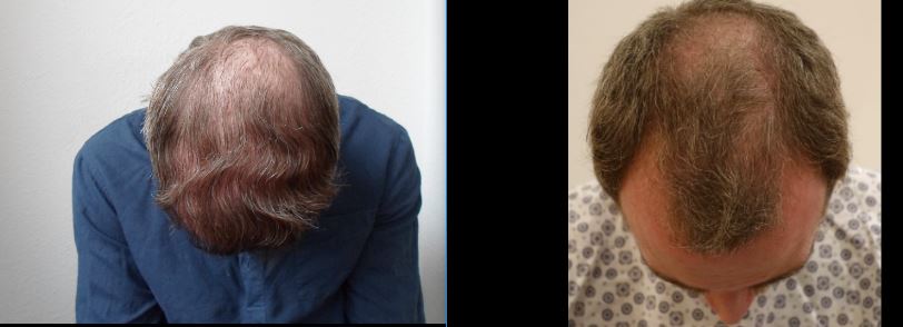 WhatsApp Image 2018-04-19 at 11.16.22 (1).jpeg