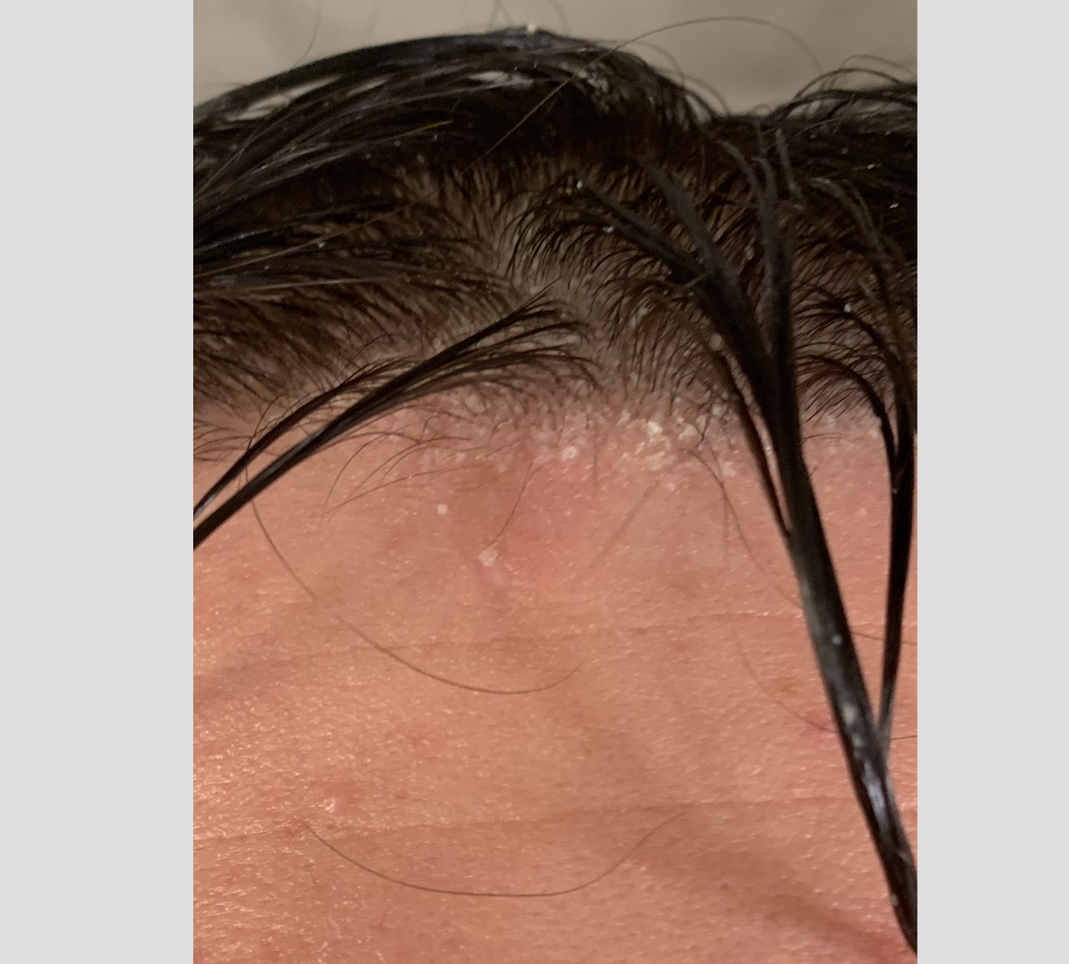 white substance .png