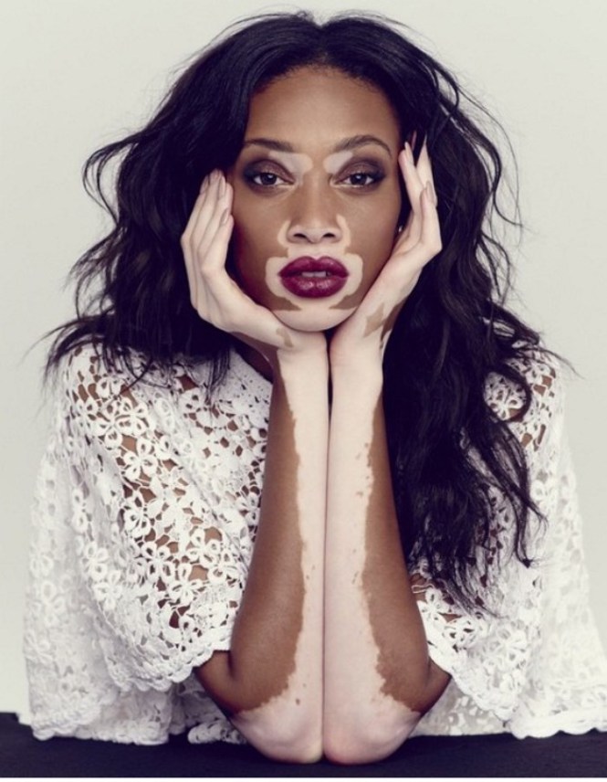 Winnie-Harlow.jpg