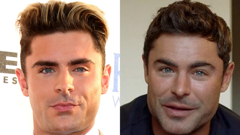 Zac-Efron-before-and-after.jpg