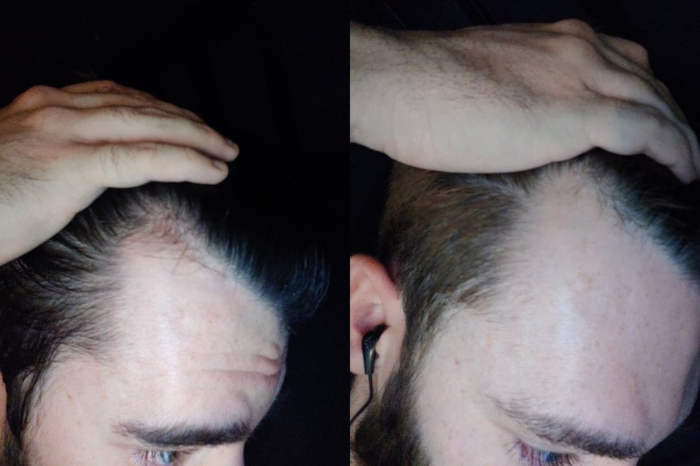 ZomboDroid 01082019102443.jpg