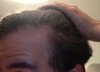 hairline.jpg