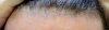 hairline_closeup.jpg