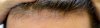 hairline_closeup2.jpg