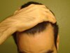 hairline.jpg